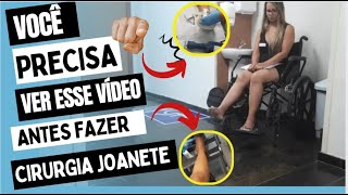 TUDO SOBRE MINHA CIRURGIA DE JOANATE NÃƒO FAÃ‡A ANTES DE VER ESSE VÃDEO [upl. by Laughton]