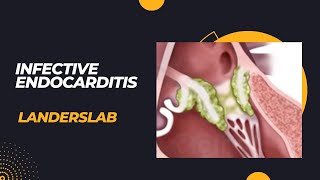 Infective Endocarditis [upl. by Adnoloy]