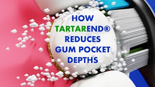 How Tartar End Reduces Gum Pocket Depths [upl. by Lantha]