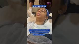 How do dermatologists or cosmetologist treat acne  Dr Vasundhara shorts [upl. by Colvin]