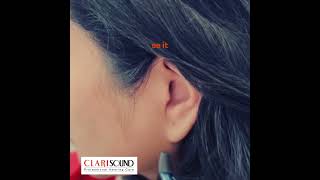 Can you see our invisible hearing aid [upl. by Calvo]