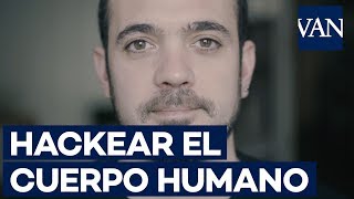 Un chip implantado en el cuerpo humano ¿para qué sirve [upl. by Yanrahc178]