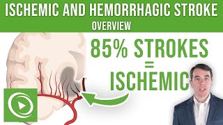 Overview of Ischemic and Hemorrhagic Stroke  Lecturio [upl. by Laetitia]