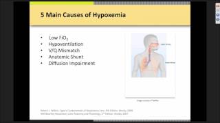 High Flow Nasal Cannula Therapy [upl. by Daniels]