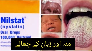 nilstat drops uses in urdu  nilstat drops how to use  nilstat nystatin [upl. by Anesusa]