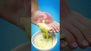 Giant blister popped recommended fypシ゚viral viral funny fyp shorts [upl. by Dlanigger24]