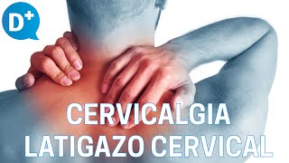 Causas y tratamiento de la cervicalgia y del latigazo cervical [upl. by Eidnahs]