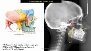 Identifiable anatomical structures in lateral cephalometric radiograph ceph tracing 1 [upl. by Abba765]