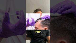 Best PRP Treatment For Hair Loss [upl. by Ezarra]