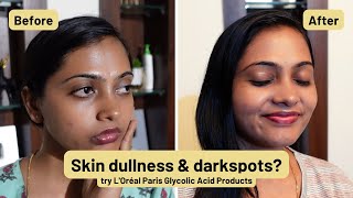 What Is Glycolic Acid amp What Is Glycolic Acid Used For AHAs  LOréal Paris Glycolic Acid Products [upl. by Frazer]