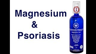 Magnesium and Psoriasis [upl. by Eniagrom73]