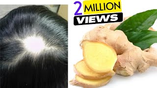 Ginger Juice to Cure Baldness amp Regrow New Hair  Sushmitas Diaries [upl. by Joli]