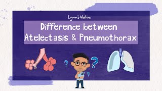 Atelectasis vs Pneumothorax atelectasis pneumothorax [upl. by Spada]