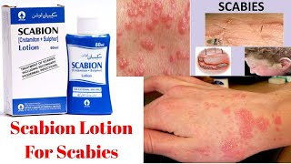 Scabion Lotion uses In Urdu [upl. by Simara]