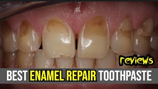 🦷 Best Enamel Repair Toothpaste Review 2024 Sensodyne Crest amp ARM amp Hammer 🌟 [upl. by Leahcir]