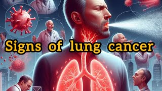 10 SIGNS OF LUNG CANCER YOU SHOULDNT IGNORE [upl. by Jacobba997]