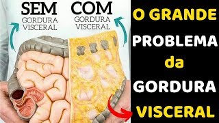 Como Perder Gordura Visceral É mais Fácil do que Você Pensa [upl. by Drahser]