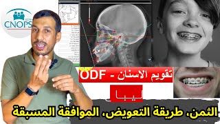 تعويض كنوبس تقويم الاسنان ليباغ الشروط التعويض analyse céphalométrique bilan ODF [upl. by Bethel876]