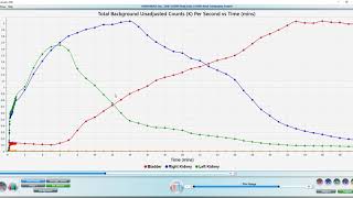 pMRI  How to Analyze a MAG3 Renogram [upl. by Vivica]