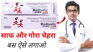 Medisalic Ointment Cream Review  medisalic cream  how to use medisalic cream [upl. by Koball935]