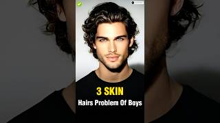 4 Skin amp Hair Problems Every Man Faces ✅  shorts viral [upl. by Cherie]