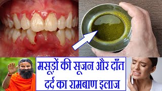 मसूड़ों की सूजन और दाँत दर्द का रामबाण इलाज  Effective Treatment of Gingivitis and Toothache [upl. by Edlun909]