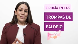 ¿La cirugía soluciona los problemas en las trompas de Falopio [upl. by Sualohcin]