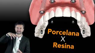 Implante Dentário Porcelana ou Resina [upl. by Nitsa]