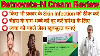 BetnovateN। BetnovateN Skin cream review 2023। How to uses betnovate n skin cream on face। [upl. by Ehrsam2]