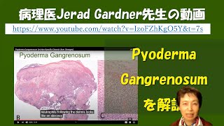 Pyoderma gangrenosumの病理組織像の解説動画 [upl. by Yerot]