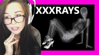 Kaceytrons XRays [upl. by Bohs409]