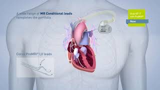 Biotronik pacemaker EVIA [upl. by Eentirb]