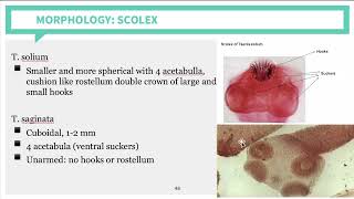 Parasitology Cestodes Part 2 [upl. by Lilias942]