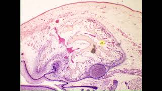 Cancellous spongy bone Pig Embryo snout [upl. by Adnahcir]