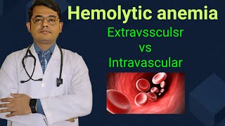 Hemolytic anemia Extravsscular vs Intravascular  Simplified explanation [upl. by Ilat102]