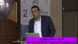 Ligamentoplastie du genou LCA جراحة الرباط الصليبي الامامي [upl. by Ojimmas]