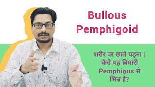 Bullous Pemphigoid  शरीर पर छाले पड़ना  कैसे यह बिमारी Pemphigus से भिन्न है pemphigus blisters [upl. by Alansen]