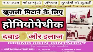 Homeopathic medicine for Eczema Ringworm Eczema दाद खाज खुजली की दवाखुजलीitchingएक्जिमा [upl. by Andreas]