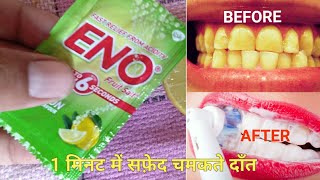 Eno का ये छोटा सा उपाय आपके गंदे पिले दांतो को चमका देगा teeth whitening [upl. by Eentroc]