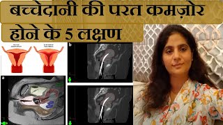 Thin Endometrium 5 लक्षण इलाज कैसे करे गर्भधारण  Endometriosis Pregnancy [upl. by Phaedra39]