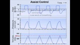 Ventilator Modes Mechanical Ventilation  Lecture 7 [upl. by Neerac]