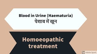 पेशाब में रक्त का कारण Blood in Urine Haematuria homoeopathic treatment [upl. by Tlok677]