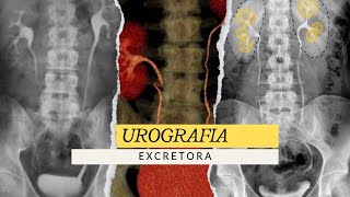 UROGRAFIA EXCRETORA  ESTUDIO RADIOLÓGICO radiologia radiology medico [upl. by Alhan]