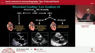 Aortic stenosis in echocardiography Tips Tricks and Pearls [upl. by Uke703]