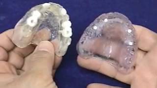 Radiographic and Surgical Implant Templates for the Completely Edentulous Fabrication Technique [upl. by Ycnaf443]