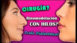 3 Alternativas para una NARIZ PERFECTA 🔥 Rinoplastia Rinomodelación con hilos o hialuronico [upl. by Ahsrav]