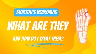 What is a Morton’s Neuroma  Chiropractor  Kennewick WA [upl. by Stronski]