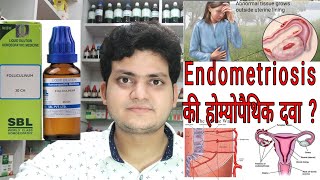 Endometriosis  Homeopathic medicine for Endometriosis [upl. by Marya]