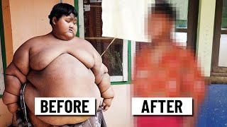 Amazing Transformation of The Worlds Fattest Boy [upl. by Ahseinod650]