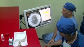 Catalys Laser Cataract Surgery System  MDEA 2012 Finalist [upl. by Brine]